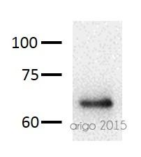 Phospho-NFkB p65 Antibody Duo (Total, pT435)