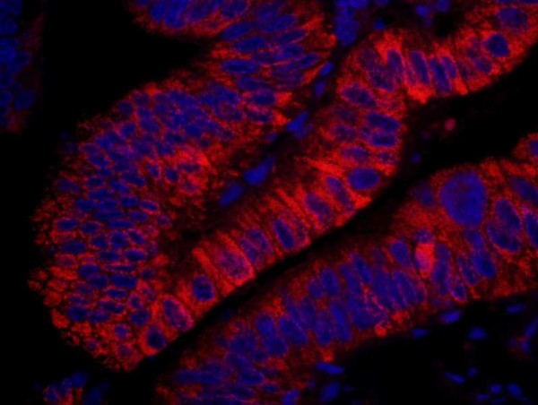 Anti-ARHGEF5 (IHC)