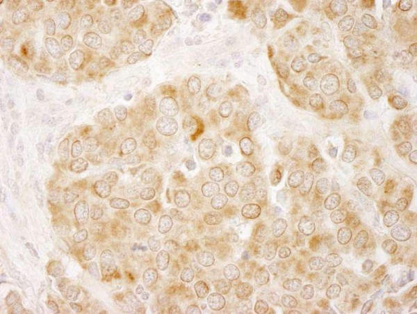 Anti-IRS1 (IHC)