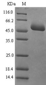 Mucosal addressin cell adhesion molecule 1 (MADCAM1), partial, human, recombinant