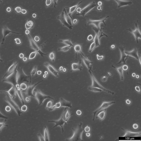 SK-MEL-5 Cells