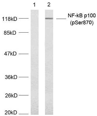 Anti-phospho-NFkB p100/p52 (Ser870)