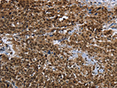 Anti-PRDM2
