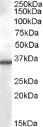 Anti-AKR1B10, C-terminal