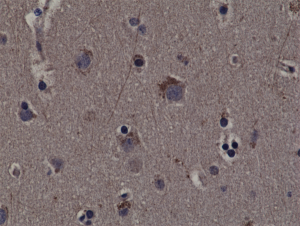 Anti-Phospho-Rsk1 (Thr359/Ser363) (human), Rabbit Monoclonal (RM233)