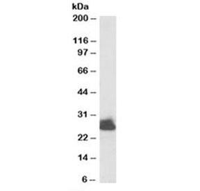 Anti-Triosephosphate isomerase