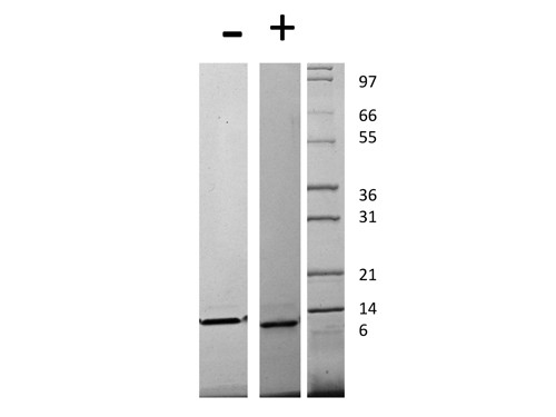 Monocyte Chemotactic Protein-4 (CCL13)