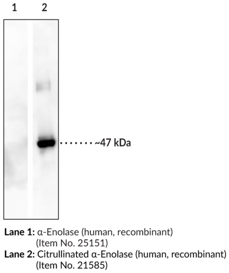 Anti-Citrullinated a-Enolase (Clone 4A7)