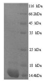 Protein S100-A7A (S100A7A), partial, human, recombinant