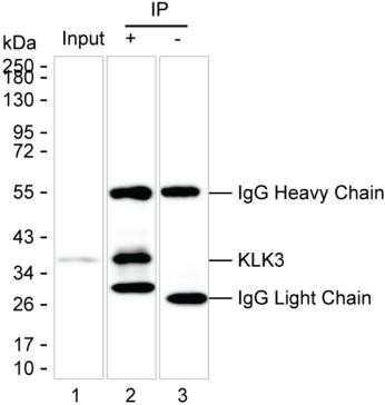 Anti-KLK3