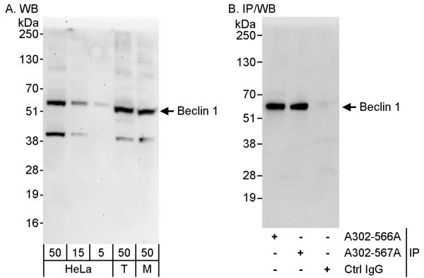 Anti-Beclin 1