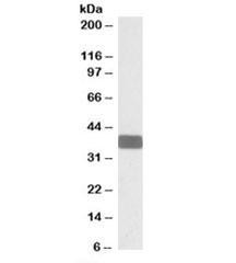 Anti-WNT9B