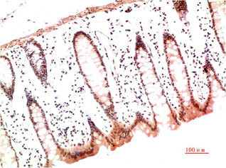 Anti-COL1A1 Monoclonal