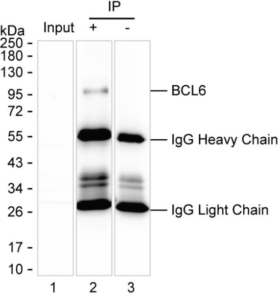 Anti-BCL6