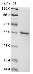 Retinoic acid-induced protein 3 (GPRC5A), partial, human, recombinant