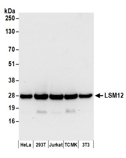 Anti-LSM12