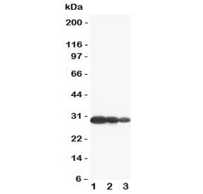 Anti-Aquaporin 6