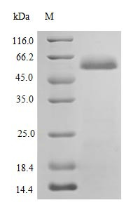 Protein disulfide-isomerase protein (P4HB), partial (Active), human, recombinant
