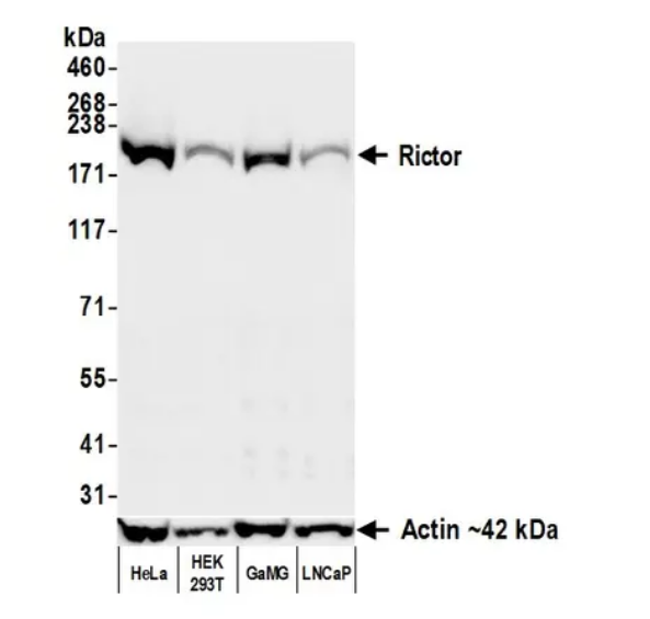 Anti-Rictor Recombinant Monoclonal