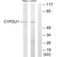 Anti-CYP2U1