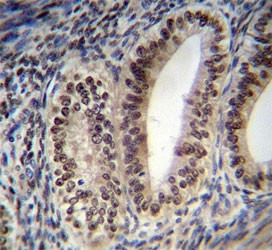Anti-Progesterone Receptor
