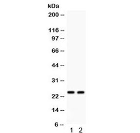 Anti-Lipocalin 2 / NGAL / LCN2