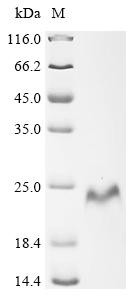 Laminin subunit gamma-2 (LAMC2), partial, recombinant human