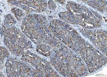Anti-Poliovirus Receptor / PVR, clone 9B9F1