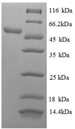 60S ribosomal protein L18 (RPL18), partial, human, recombinant
