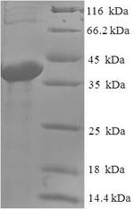 Abhydrolase domain-containing protein 14B (ABHD14B), human, recombinant