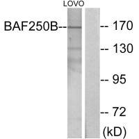 Anti-ARID1B