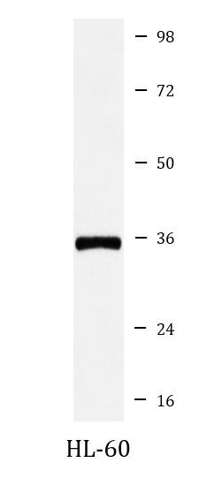 Anti-DMRT1