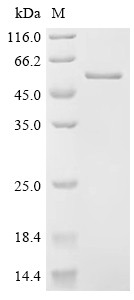 DCC-interacting protein 13-alpha (APPL1), partial, human, recombinant