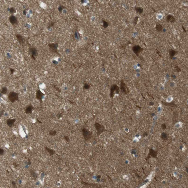 Anti-MFAP3