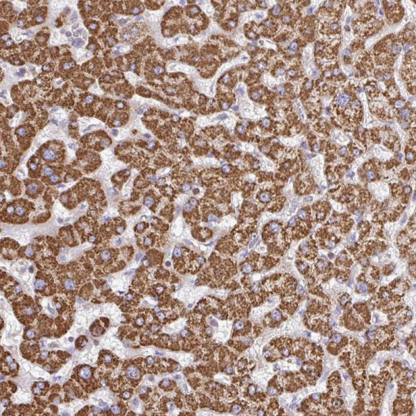 Anti-TTC39B