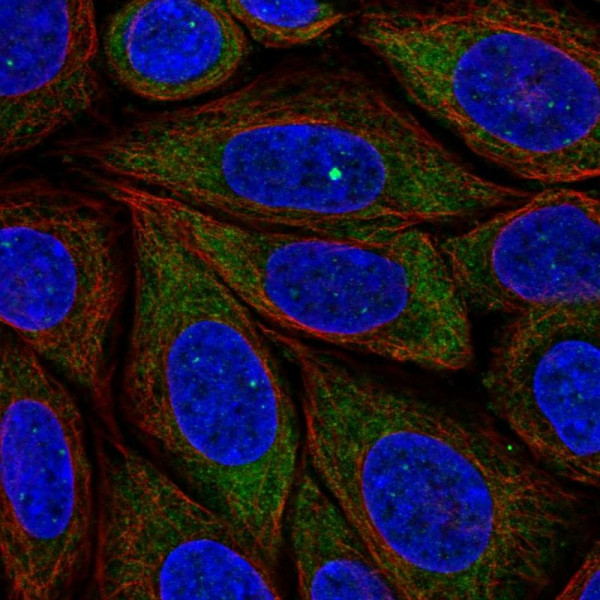 Anti-PRRC2B