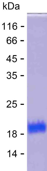 Recombinant Human KCTD6 Protein