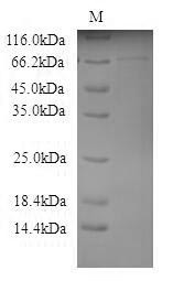 Galactocerebrosidase (Galc), mouse, recombinant