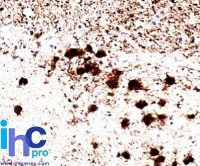 Anti-pgp9.5 (UCHL-1)(31A3), CF405S conjugate, 0.1mg/mL