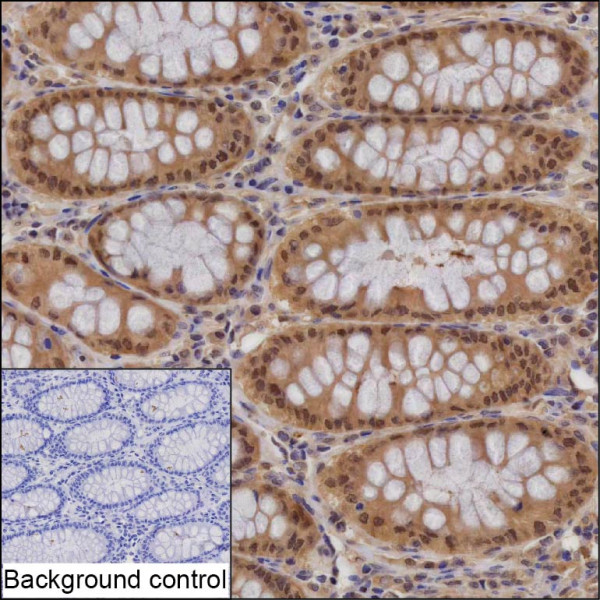 Anti-PSMA1
