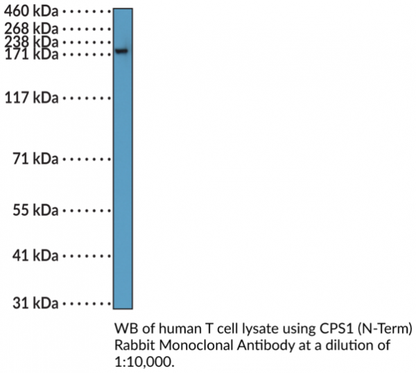 Anti-CPS1 (N-Term) Rabbit Monoclonal Antibody (RM395)