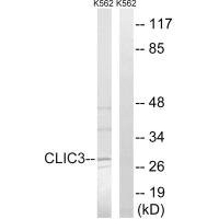 Anti-CLIC3