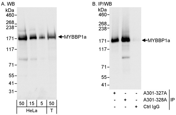 Anti-MYBBP1A