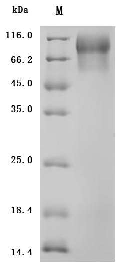 Mucin-13(MUC13),partial (Active), human, recombinant