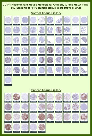 Anti-Thrombomodulin / THBD / CD141, clone MSVA-141M