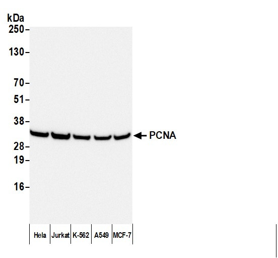 Anti-Mouse IgG-heavy and light chain, HRP conjugated