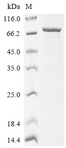 Sphingomyelin phosphodiesterase (SMPD1), human, recombinant