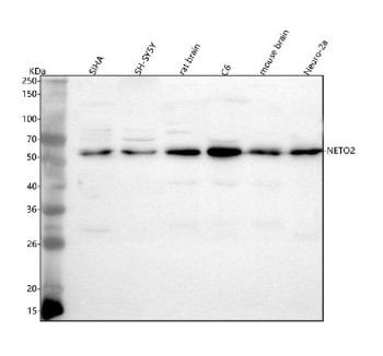Anti-NETO2 / Neuropilin and tolloid-like protein 2
