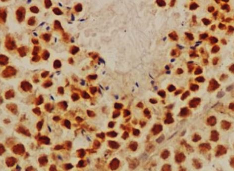 Anti-alpha Synuclein