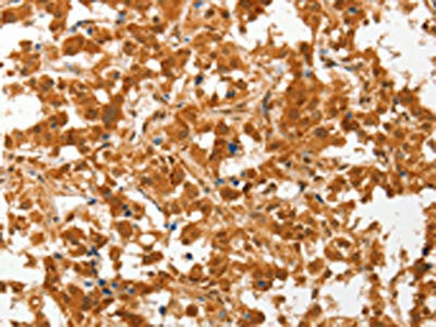 Anti-COL4A3BP